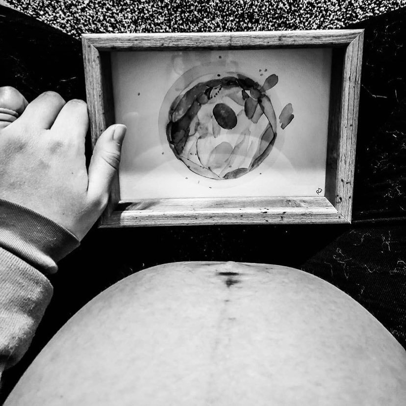 &ldquo;Want to know a secret?
Okay, well it's not really a secret because I'm pretty open on here, but I'm gonna be honest with ya'll, I did not have a lot of hope for our embryo transfer. I've seen other warriors struggle, and I've seen the stats on embryo transfers taking, so I was fully prepared for it not to work.
So prepared, in fact, that I practiced songs I would cover to display the grief of a failed transfer. I made no plans for what to do if it worked. Once it did work, I was terrified. It took me a while to feel a bond with him. I was so scared to get excited and plan for him because I didn't want my heart to fall apart again.
And ya know what? I'm still terrified. The days are literally ticking down and I sit sometimes, just staring at this miracle belly wondering what in the hell I've done. Logically, I know I can birth this baby. Logically, I know that we're ready to be parents, but telling this brain that?? Yea, that's a different story.
I'm starting to think adding a countdown widget to my home screen was a bad idea, because this anxiety building up is bound to explode at some point.
If you're feeling anything similar, here's something a friend told me that has helped. The anxiety is normal, the paranoia is normal, the fear is normal. All of these feelings are coming from a place of unconditional love. It's our instincts kicking in, and while the emotions can be confusing, they're perfectly normal.
There's no need to feel guilty if you're feeling more than one way. Because while this anxiety feels suffocating, I'm also so incredibly excited I can barely contain it.&rdquo; -@batstitchbailey
.
.
Pregnancy after infertility is hard, and often it&rsquo;s not talked about nearly enough, for a lot of reasons, survivor&rsquo;s guilt being one of them. But the truth is, the scars of infertility don&rsquo;t fade the minute you get a positive pregnancy test, and it&rsquo;s important for those stories to be shared as well. So today we&rsquo;re sending lots of love to those navigating the anxiety of pregnancy after infertility &amp; loss, especially with so much other uncertainty going on in the world. 💖
.
.
Are you currently pregnant after infertility or loss? Comment below &amp; find your tribe!